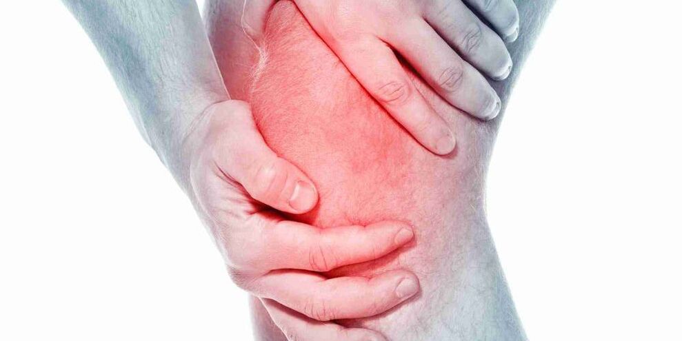 Sakit di lutut bengkok atau lurus adalah gejala arthrosis sendi lutut