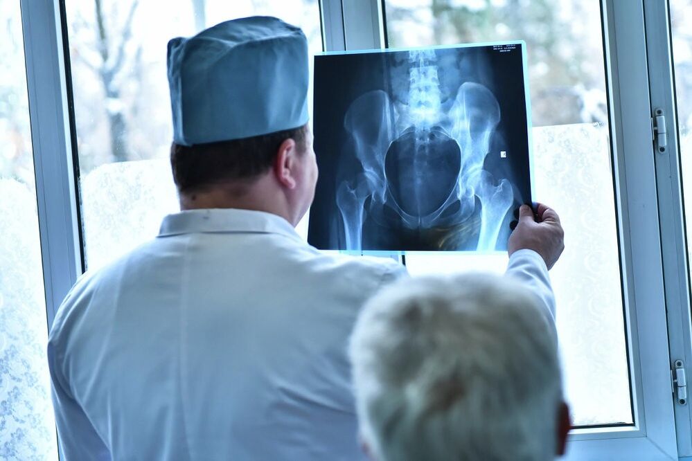 Doktor melihat gambar sendi pinggul dengan arthrosis